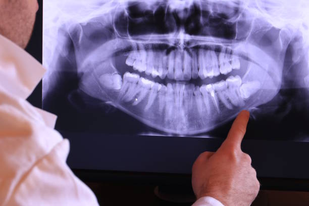 Best Urgent Care for Lost Fillings or Crowns in Huron, OH