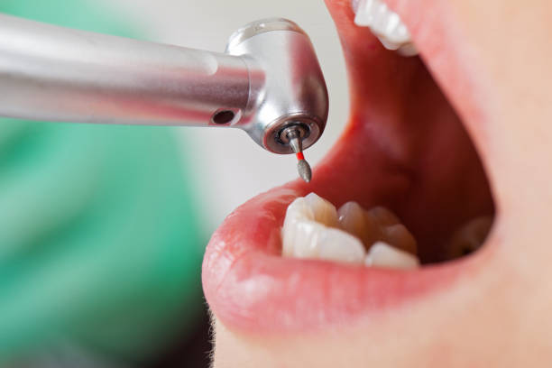 Best Pediatric Emergency Dentist in Huron, OH